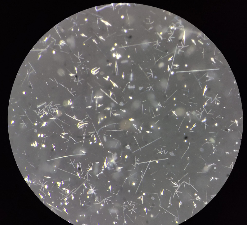 Plankton under a microscope