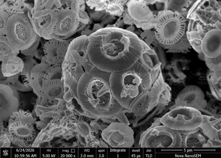 Electron microscopy of coccolithophore
