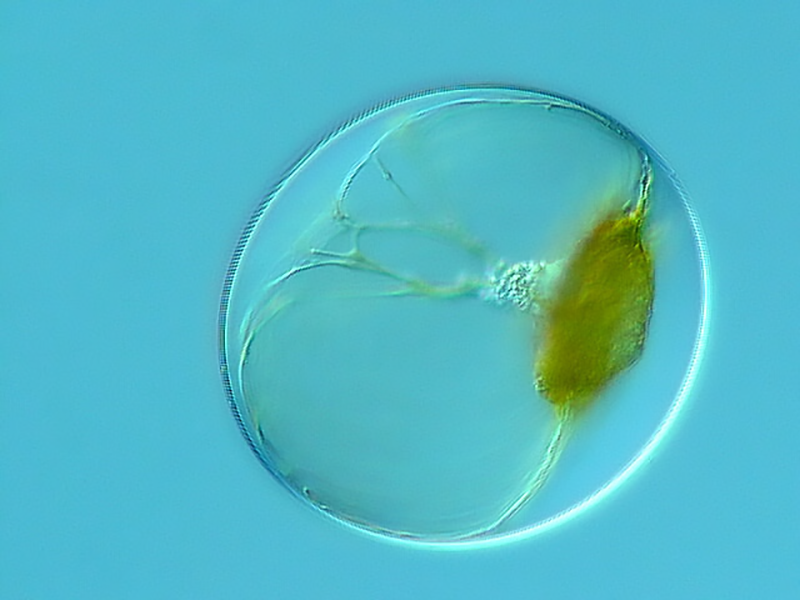 Microscope image of Noctiluca, a marine dinoflagellate